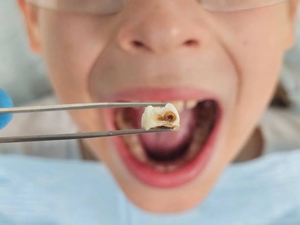 Best Emergency Denture Repair in Blackshear, GA